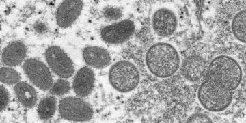 Ce que l’on sait sur la variole du singe, la maladie qui est en train de se propager à travers le monde