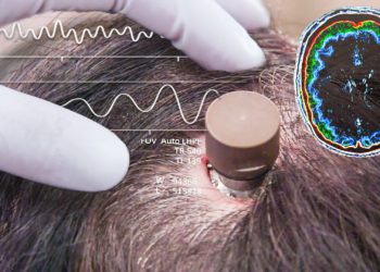 Elon Musk va greffer un ordinateur dans un cerveau humain dans “moins de 6 mois”