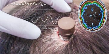 Elon Musk va greffer un ordinateur dans un cerveau humain dans “moins de 6 mois”